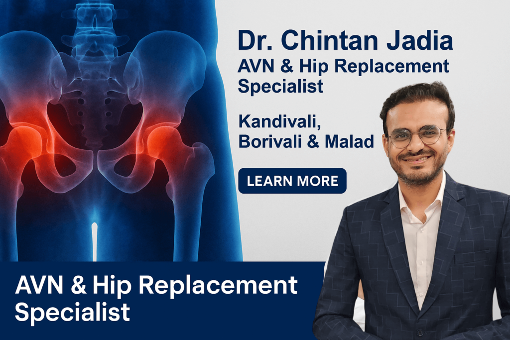 AVN & Hip Replacement Surgeon in Kandivali | Dr. Chintan Jadia